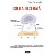 Colita ulcerata - Peter Cartwright