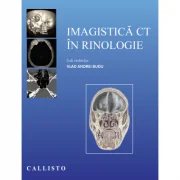 Imagistica CT in rinologie - Vlad Andrei Budu