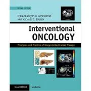 Interventional Oncology: Principles and Practice of Image-Guided Cancer Therapy - Jean-Francois H. Geschwind, Michael C. Soulen