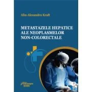 Metastazele hepatice ale neoplasmelor non-colorectale - Alin-Alexandru Kraft